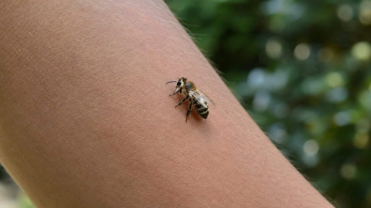 Abeja posada sobre la piel de un brazo humano