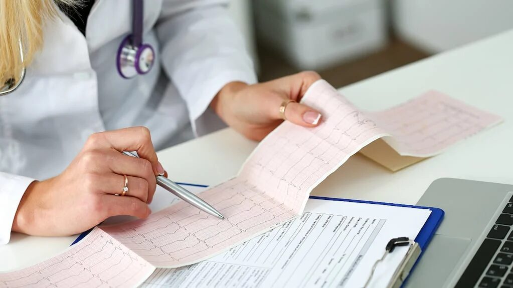 Fibrilación auricular y su impacto en la salud cardiovascular