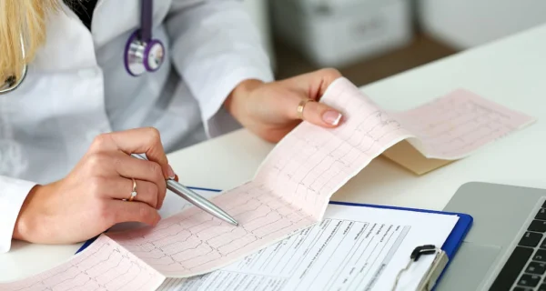 Fibrilación auricular y su impacto en la salud cardiovascular
