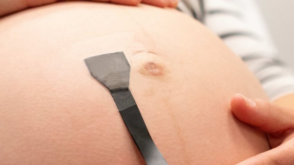 Parche de ultrasonido flexible para monitoreo fetal