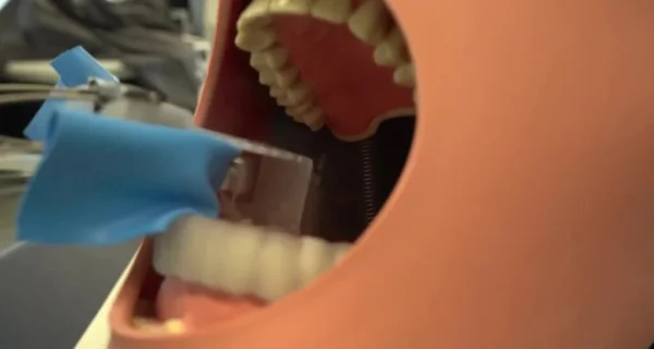 Robot dental MIR asistiendo a un dentista