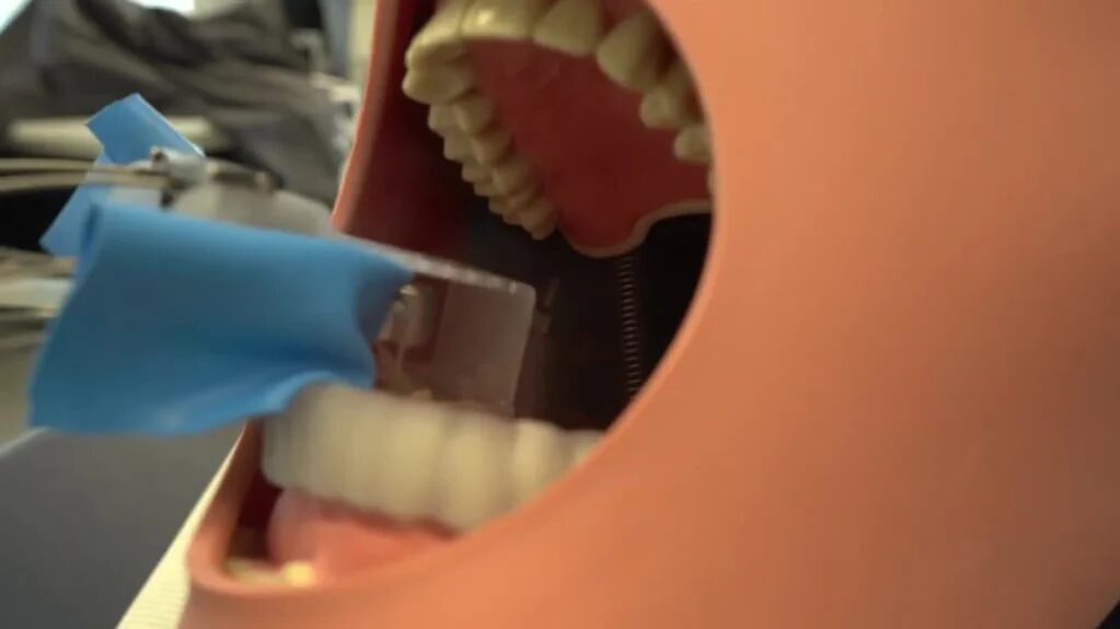 Robot dental MIR asistiendo a un dentista