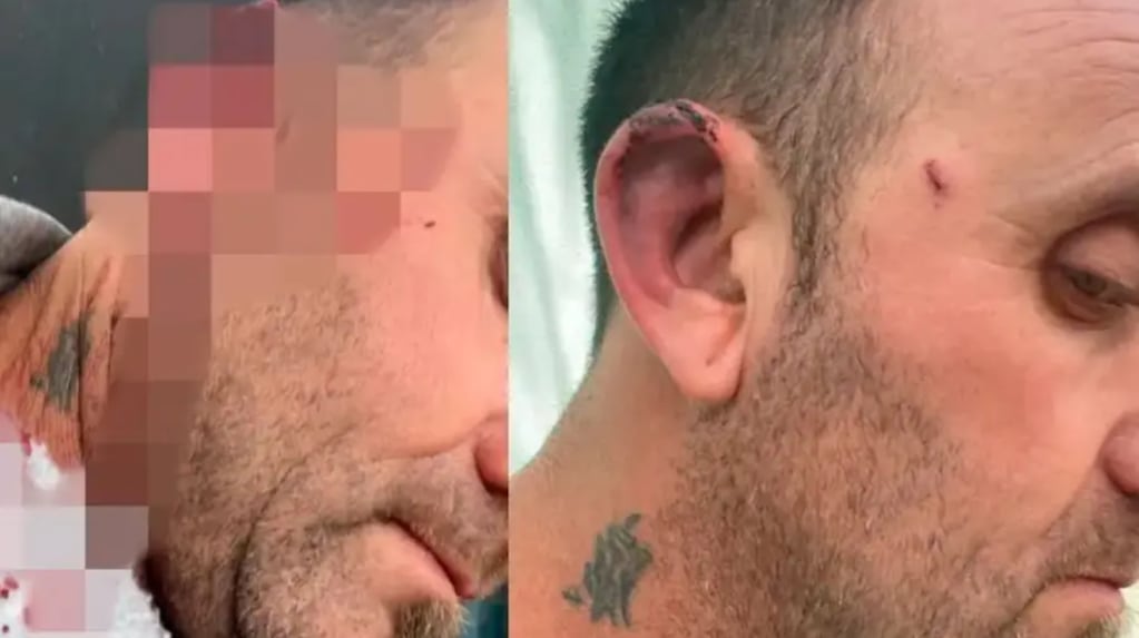 Intendente Martín Ruiz tras la agresión en Pueblo Brugo