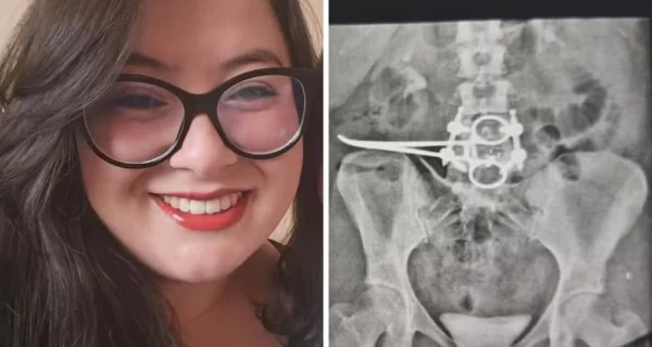 Érica Bannai en el hospital tras su cirugía