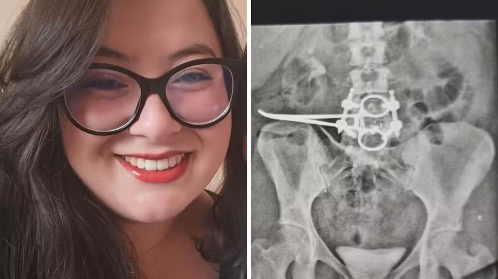 Érica Bannai en el hospital tras su cirugía